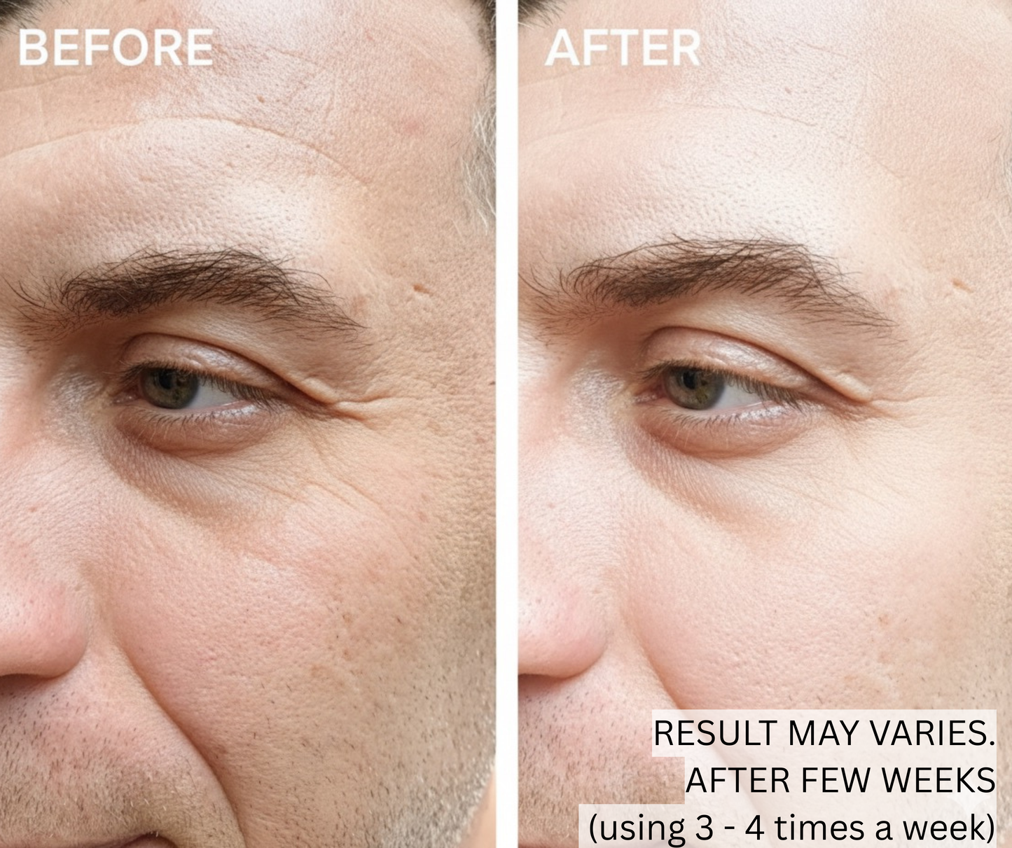 Before and after comparison of a man's eye area with text indicating a result may vary after a few weeks.